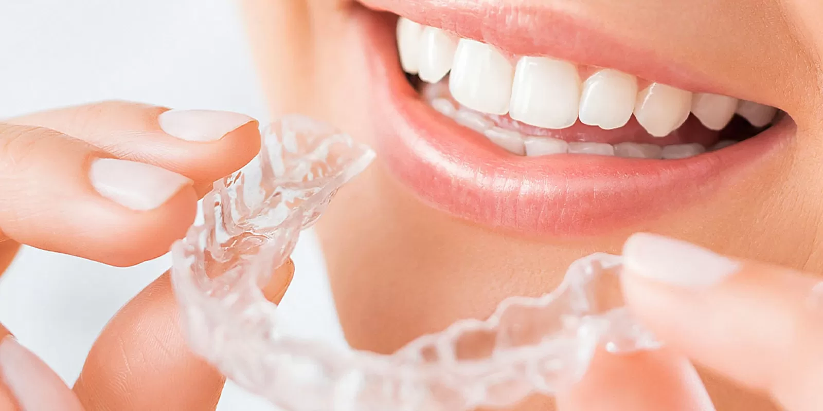 マウスピース矯正とワイヤー矯正の違いを徹底比較！