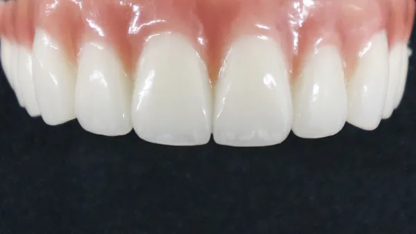 銀歯から白い歯へ｜セラミック治療で変わる笑顔と印象
