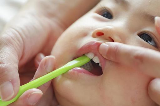 乳歯の虫歯が永久歯に及ぼす影響とは