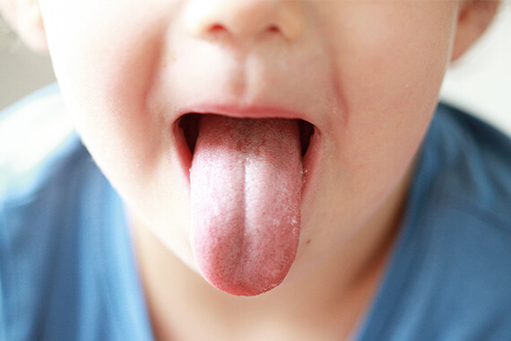 舌をよく噛んでしまうのはなぜ？〜知られざる“舌を噛むクセ”の原因と対策〜