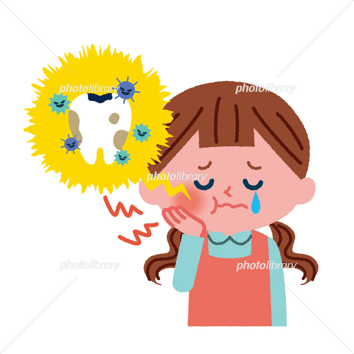 むし歯は早期発見・早期治療