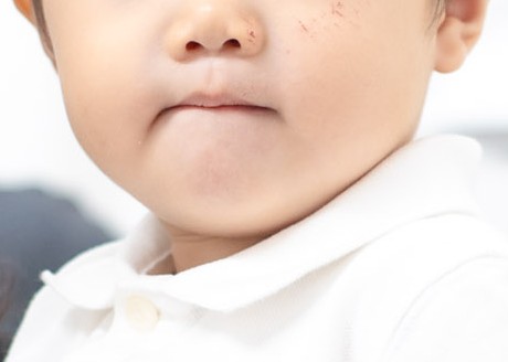 子どもの歯並び、放置するとどうなる？